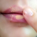foraywhile_plumy lips