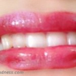 whitening teeth