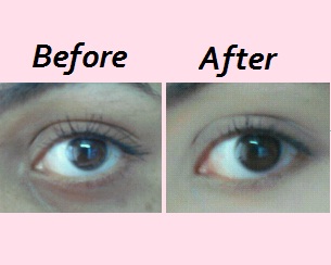 5 Eye Masks to Remove Dark Circles and Wrinkles