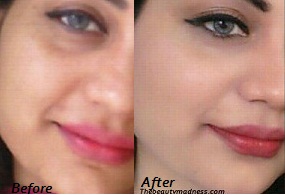 Top 7 Remedies to Treat Uneven Skin Tone