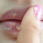 conceal lips