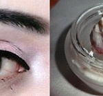 remedies_for_bright_eyes