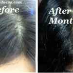 how to grow hair on bald heads naturally