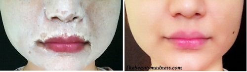 5 Skin Lightening Corn Flour Face Packs