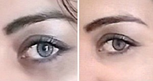 10 Easy Tips to Get Rid of Dark Circles Instantly