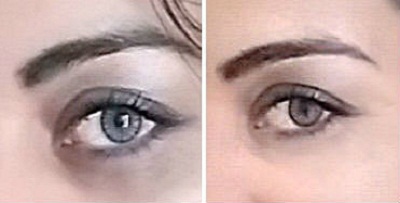 10 Easy Tips to Get Rid of Dark Circles Instantly