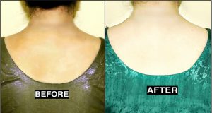 Back Scrub – For Fair, Smooth, Clear, Pigmented & Tan Free Back