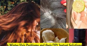 6 Winter Hair Problems and their Quick Homemade Solutions