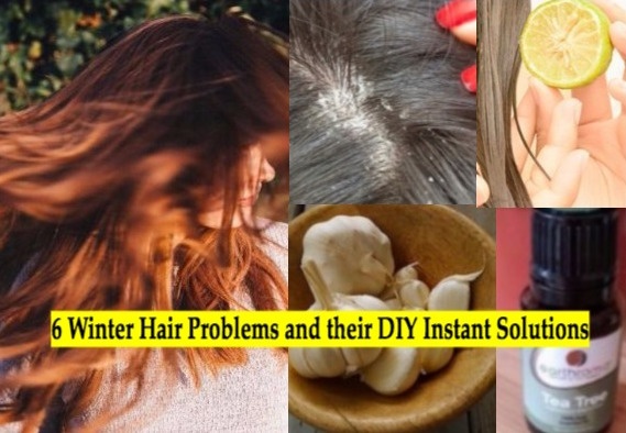6 Winter Hair Problems and their Quick Homemade Solutions
