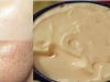 One Simple Cream that will Remove all Dark Spots in 10 Days