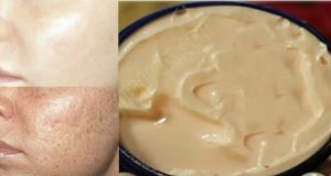 One Simple Cream that will Remove all Dark Spots in 10 Days