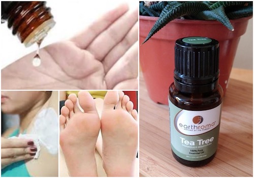 teatreeoilbenefits