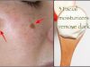 3 Facial Moisturizers You can Make at Home To remove Dark Spots