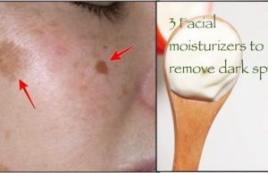 3 Facial Moisturizers You can Make at Home To remove Dark Spots