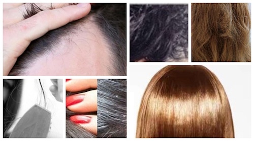No.1 Home Remedies for Dry Hair, Split Ends, Oily Scalp, Hair Loss & Dandruff