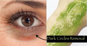 5 Quick Beauty Tips To Remove Dark Under Eye Circles
