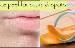An amazing Face Peel to Fade Spots & Scars instant