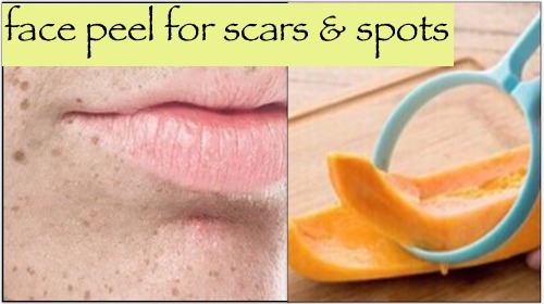An amazing Face Peel to Fade Spots & Scars instant