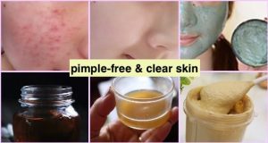 Top 5 tips for Oily skin to keep it clear & pimple-free