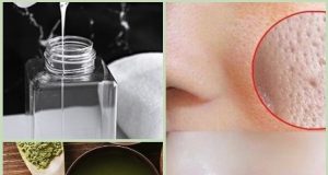 How to Tighten Pores and Tone Your Face