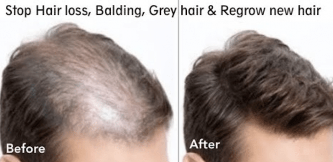 thebeautymadness-hair-growth