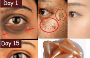 From Acne to Wrinkles: Top 10 All-Natural Remedies for Your Biggest Beauty Woes!