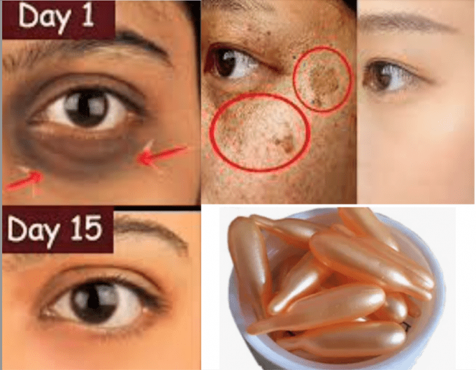 From Acne to Wrinkles: Top 10 All-Natural Remedies for Your Biggest Beauty Woes!