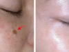 Lighten Up Your Skin: 6 Genius Hacks to Clear Dark Spots