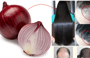 “Do you know this is the right way to use onion juice for Super Thick & Fast hair growth?”