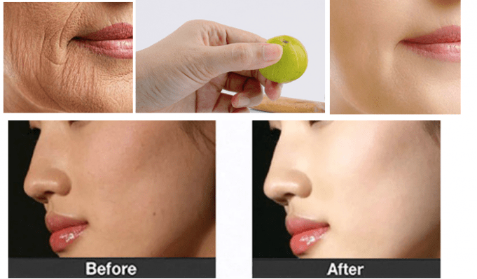 Having these 5 Indian Fruits Can improve Complexion dramatically And make you Look 5 years Younger!
