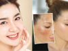 Dark Spots can be Removed Easily with the homemade Japanese Beauty Scrub