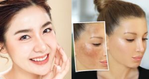 Dark Spots can be Removed Easily with the homemade Japanese Beauty Scrub