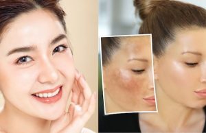 Dark Spots can be Removed Easily with the homemade Japanese Beauty Scrub