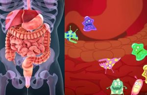 7 Bad Signs of an unhealthy gut, Do this to improve it naturally